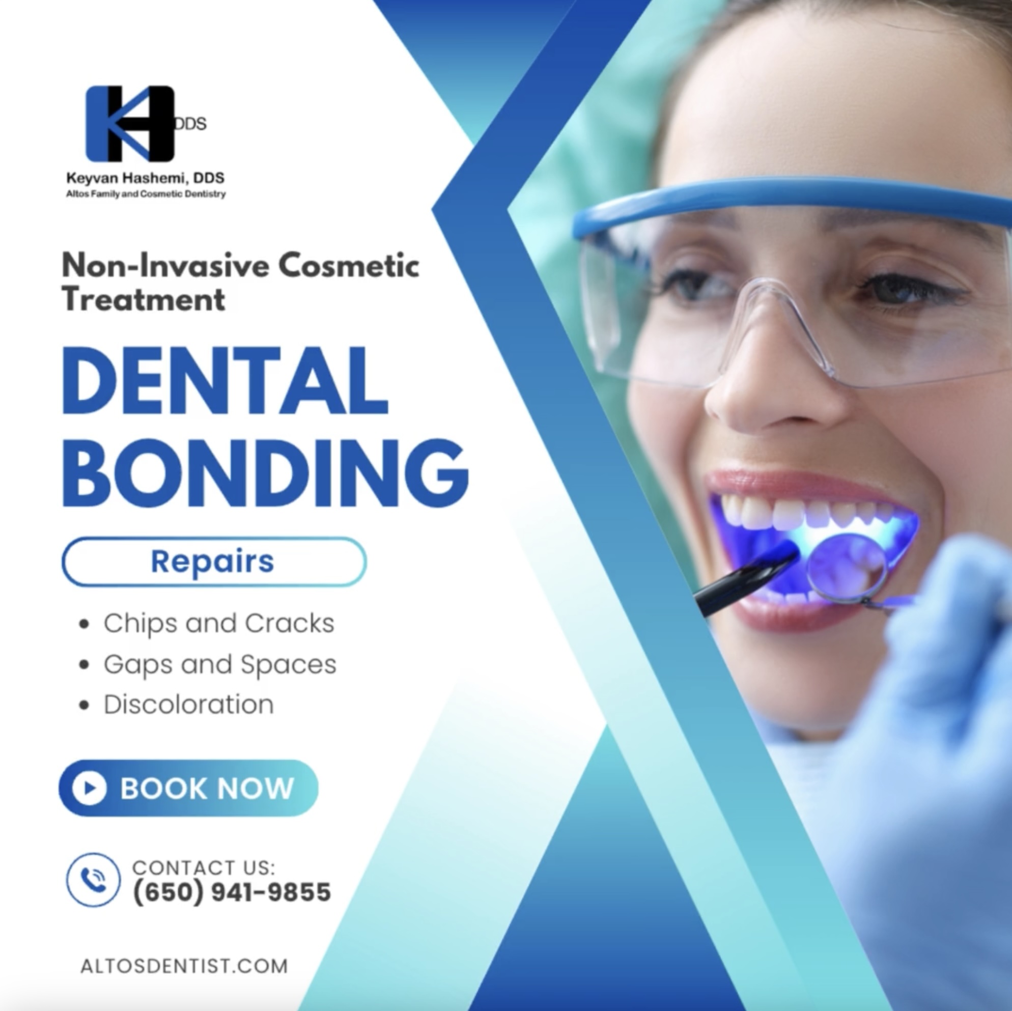 Dental Bonding Los Altos